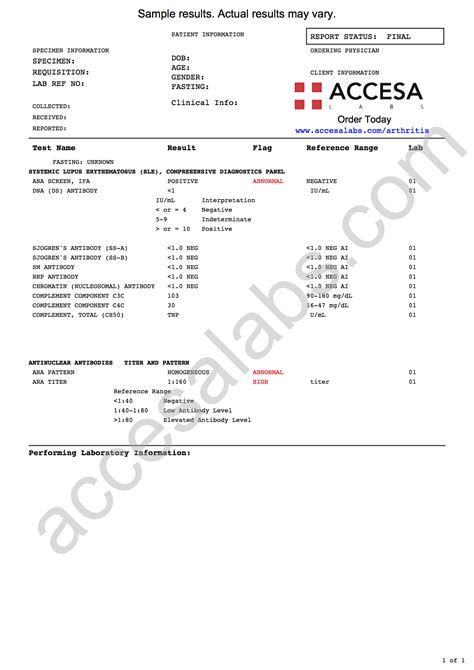 lupus blood test results|Complete Blood Count (CBC) : Johns Hopkins Lupus Center.